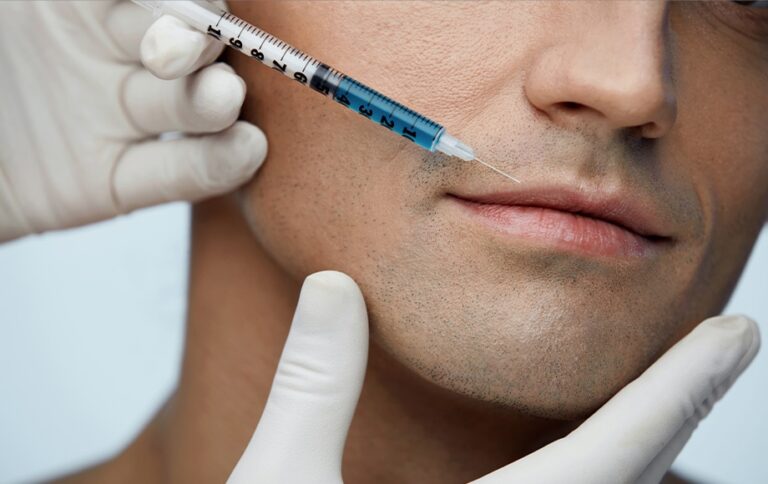 Lip Fillers Last